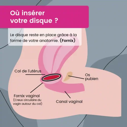 Disque menstruel