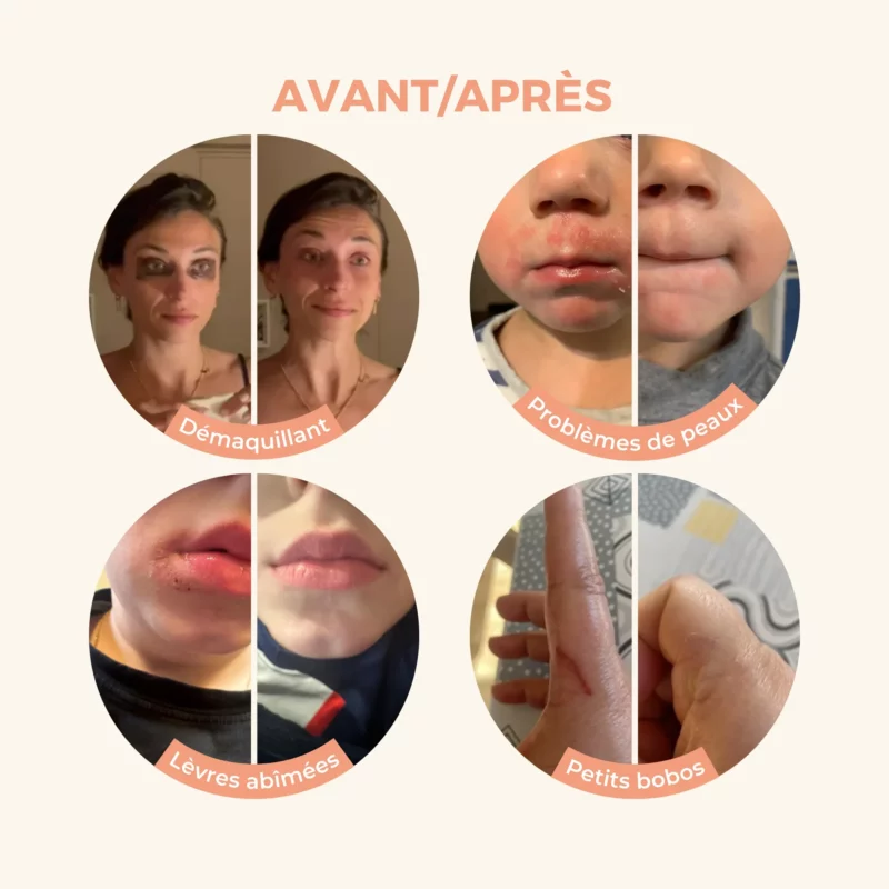 Baume Magique CBD 30ml - BIO - Les Petits Prodiges – Image 4